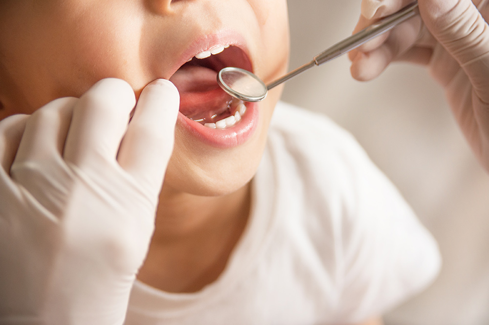 caries risk assessment by our children dentist