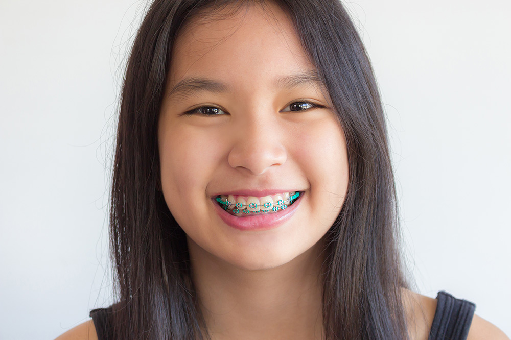 our kids dentist singapore service provides orthodontic treatment
