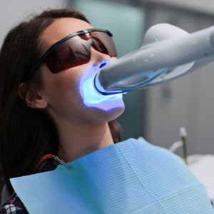 chairside teeth whitening singapore performed by dentist