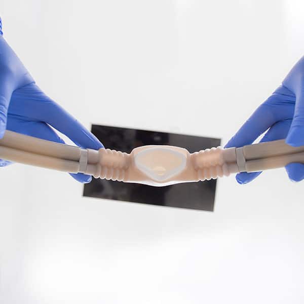 SEDATION for wisdom tooth surgery