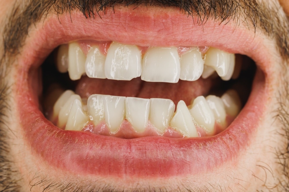 close-up image of a man’s teeth