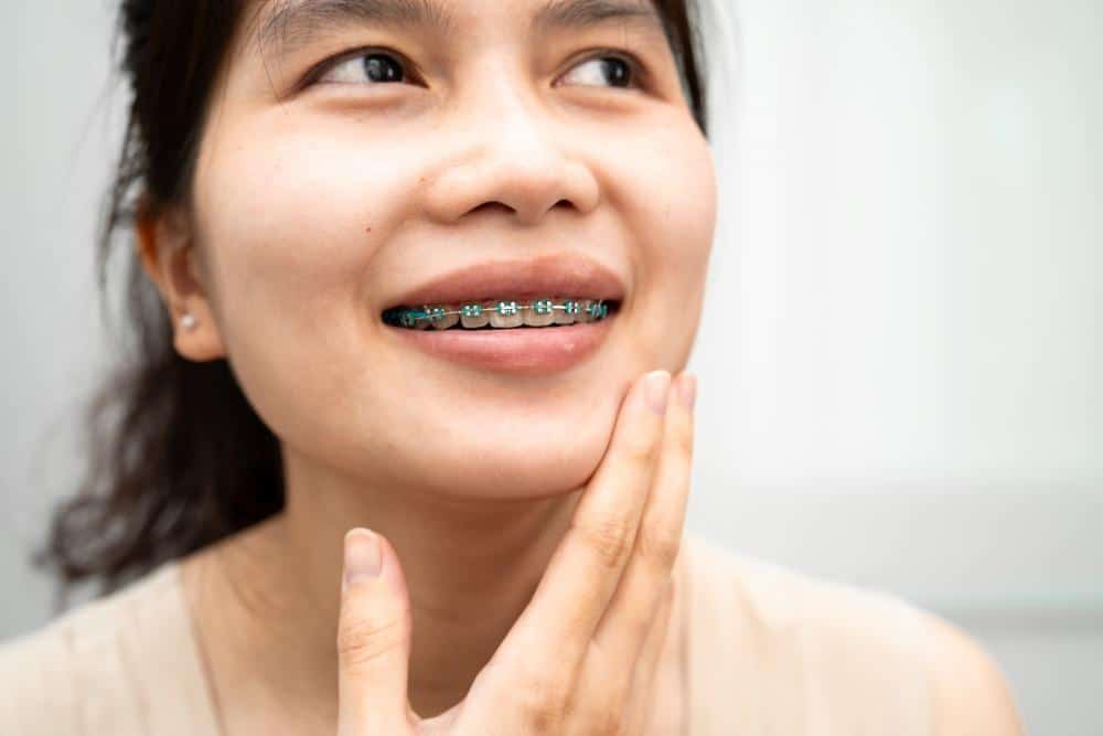 a young lady smiling with metal braces